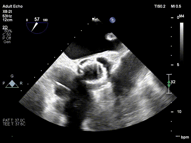 19.gif