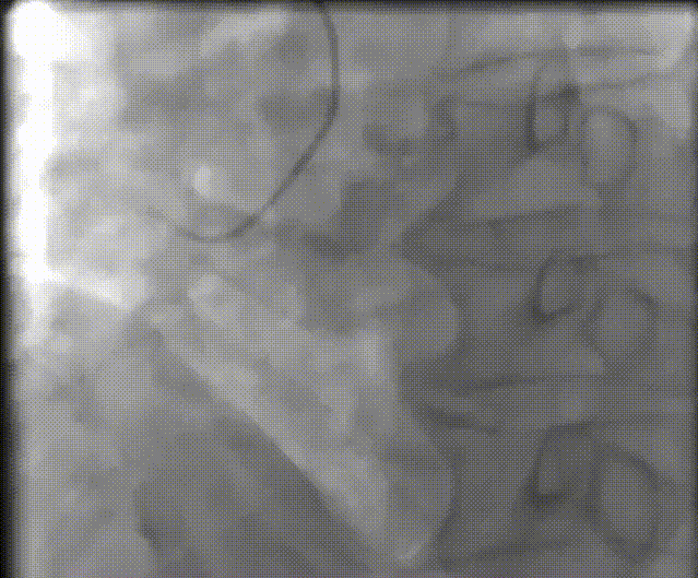 6.gif
