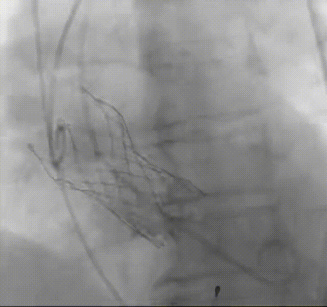 13.gif