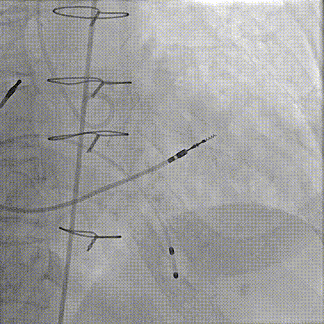 7.gif