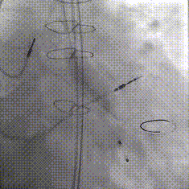 10.gif