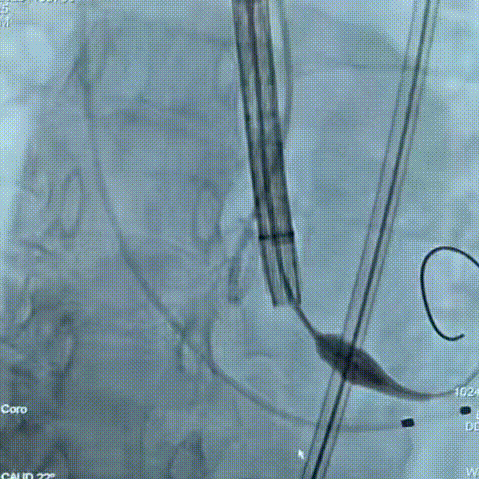 7.gif