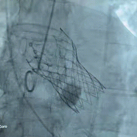 9.gif