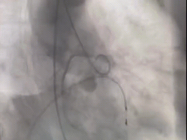 8.gif