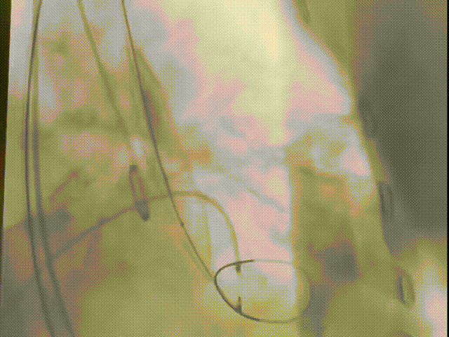 9.gif