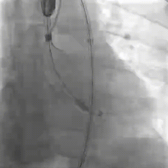 9.gif