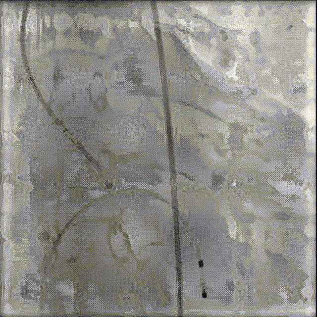 6.gif