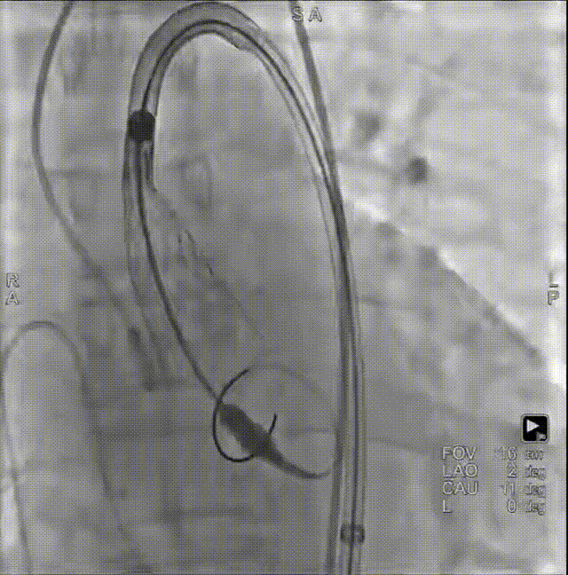 9.gif