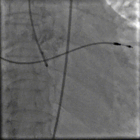 7.gif