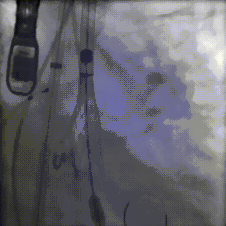 9.gif