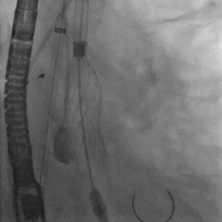 10.gif